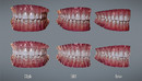 Cubebrush Realtime Teeth-缩略图